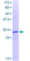 MT-ND1 Protein - 12.5% SDS-PAGE Stained with Coomassie Blue