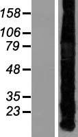 MT1A / Metallothionein 1A Protein - Western validation with an anti-DDK antibody * L: Control HEK293 lysate R: Over-expression lysate