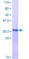 MT1A / Metallothionein 1A Protein - 12.5% SDS-PAGE of human MT1A stained with Coomassie Blue