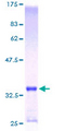 MT1E Protein - 12.5% SDS-PAGE of human MT1E stained with Coomassie Blue