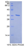 MT1E Protein - Recombinant Metallothionein 1E By SDS-PAGE