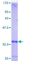 MT1F Protein - 12.5% SDS-PAGE of human MT1F stained with Coomassie Blue