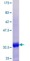 MT1G Protein - 12.5% SDS-PAGE of human MT1G stained with Coomassie Blue
