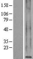 MT1X Protein - Western validation with an anti-DDK antibody * L: Control HEK293 lysate R: Over-expression lysate