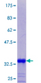 MT2A / Metallothionein 2A Protein - 12.5% SDS-PAGE of human MT2A stained with Coomassie Blue