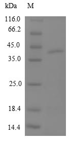 MT3 / Metallothionein 3 Protein - (Tris-Glycine gel) Discontinuous SDS-PAGE (reduced) with 5% enrichment gel and 15% separation gel.