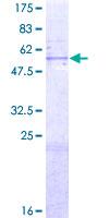 MTA1 Protein - 12.5% SDS-PAGE of human MTA1 stained with Coomassie Blue