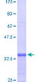 MTA1 Protein - 12.5% SDS-PAGE Stained with Coomassie Blue.