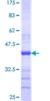 MTA1 Protein - 12.5% SDS-PAGE Stained with Coomassie Blue.