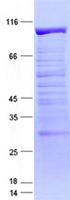 MTA1 Protein