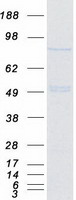 MTA1 Protein - Purified recombinant protein MTA1 was analyzed by SDS-PAGE gel and Coomassie Blue Staining