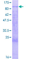 MTA2 Protein - 12.5% SDS-PAGE of human MTA2 stained with Coomassie Blue