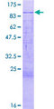 MTA2 Protein - 12.5% SDS-PAGE of human MTA2 stained with Coomassie Blue