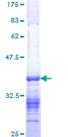 MTA2 Protein - 12.5% SDS-PAGE Stained with Coomassie Blue.
