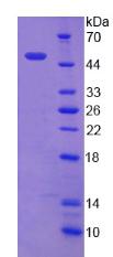 MTA2 Protein - Recombinant Metastasis Associated Protein 2 By SDS-PAGE