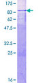 MTA3 Protein - 12.5% SDS-PAGE of human MTA3 stained with Coomassie Blue