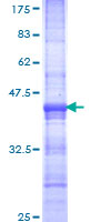 MTA3 Protein - 12.5% SDS-PAGE Stained with Coomassie Blue.