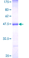 MTAP Protein - 12.5% SDS-PAGE of human MTAP stained with Coomassie Blue