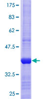 MTAP Protein - 12.5% SDS-PAGE Stained with Coomassie Blue.