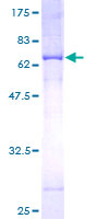 MTCH1 Protein - 12.5% SDS-PAGE of human MTCH1 stained with Coomassie Blue