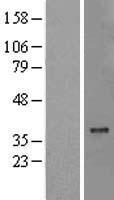 MTCH2 Protein - Western validation with an anti-DDK antibody * L: Control HEK293 lysate R: Over-expression lysate