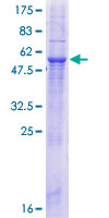 MTCH2 Protein - 12.5% SDS-PAGE of human MTCH2 stained with Coomassie Blue