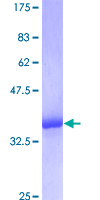 MTCP1NB Protein - 12.5% SDS-PAGE of human MTCP1 stained with Coomassie Blue