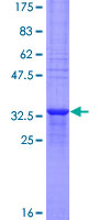 MTCP1NB Protein - 12.5% SDS-PAGE of human MTCP1 stained with Coomassie Blue
