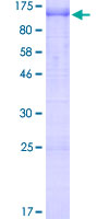 MTDH / Metadherin Protein - 12.5% SDS-PAGE of human MTDH stained with Coomassie Blue