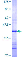 MTERF1 Protein - 12.5% SDS-PAGE Stained with Coomassie Blue.