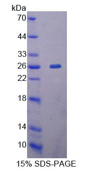 MTERF1 Protein - Recombinant Mitochondrial Transcription Termination Factor By SDS-PAGE