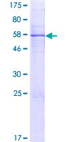 MTERF2 / MTERFD3 Protein - 12.5% SDS-PAGE of human MTERFD3 stained with Coomassie Blue