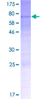 MTERF3 / MTERFD1 Protein - 12.5% SDS-PAGE of human MTERFD1 stained with Coomassie Blue
