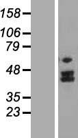 MTERF4 / MTERFD2 Protein - Western validation with an anti-DDK antibody * L: Control HEK293 lysate R: Over-expression lysate