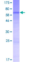 MTERF4 / MTERFD2 Protein - 12.5% SDS-PAGE of human MTERFD2 stained with Coomassie Blue