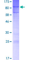 MTF2 / PCL2 Protein - 12.5% SDS-PAGE of human MTF2 stained with Coomassie Blue