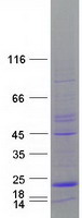 MTFP1 Protein - Purified recombinant protein MTFP1 was analyzed by SDS-PAGE gel and Coomassie Blue Staining