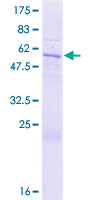 MTG1 / Mitochondrial GTPase 1 Protein - 12.5% SDS-PAGE of human MTG1 stained with Coomassie Blue