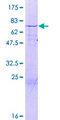 MTG2 / GTPBP5 Protein - 12.5% SDS-PAGE of human GTPBP5 stained with Coomassie Blue
