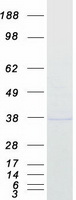 MTHFD2 Protein - Purified recombinant protein MTHFD2 was analyzed by SDS-PAGE gel and Coomassie Blue Staining