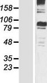 MTHFR Protein - Western validation with an anti-DDK antibody * L: Control HEK293 lysate R: Over-expression lysate
