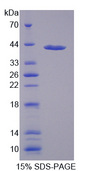 MTHFR Protein - Recombinant Methylenetetrahydrofolate Reductase By SDS-PAGE