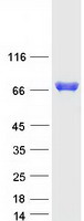 MTHFR Protein - Purified recombinant protein MTHFR was analyzed by SDS-PAGE gel and Coomassie Blue Staining
