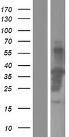 MTL5 / TESMIN Protein - Western validation with an anti-DDK antibody * L: Control HEK293 lysate R: Over-expression lysate
