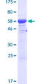 MTL5 / TESMIN Protein - 12.5% SDS-PAGE of human MTL5 stained with Coomassie Blue