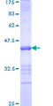 MTL5 / TESMIN Protein - 12.5% SDS-PAGE Stained with Coomassie Blue.