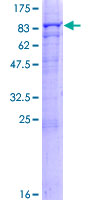 MTM1 / Myotubularin Protein - 12.5% SDS-PAGE of human MTM1 stained with Coomassie Blue