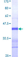 MTM1 / Myotubularin Protein - 12.5% SDS-PAGE Stained with Coomassie Blue.