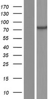 MTMR1 Protein - Western validation with an anti-DDK antibody * L: Control HEK293 lysate R: Over-expression lysate