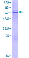 MTMR1 Protein - 12.5% SDS-PAGE of human MTMR1 stained with Coomassie Blue